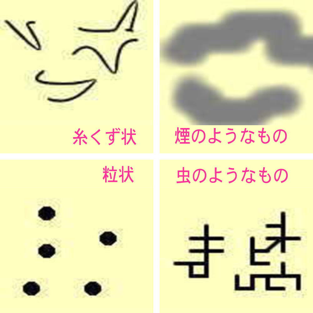 飛蚊症の見え方（糸くず状、粒状、煙のようなもの、虫のようなもの）